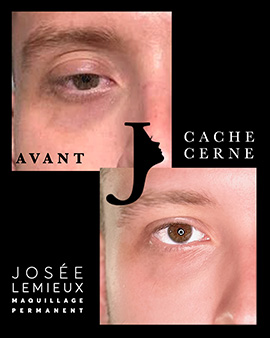 cernes Josée Lemieux