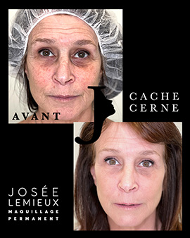cernes Josee Lemieux