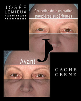 correction couleur paupière